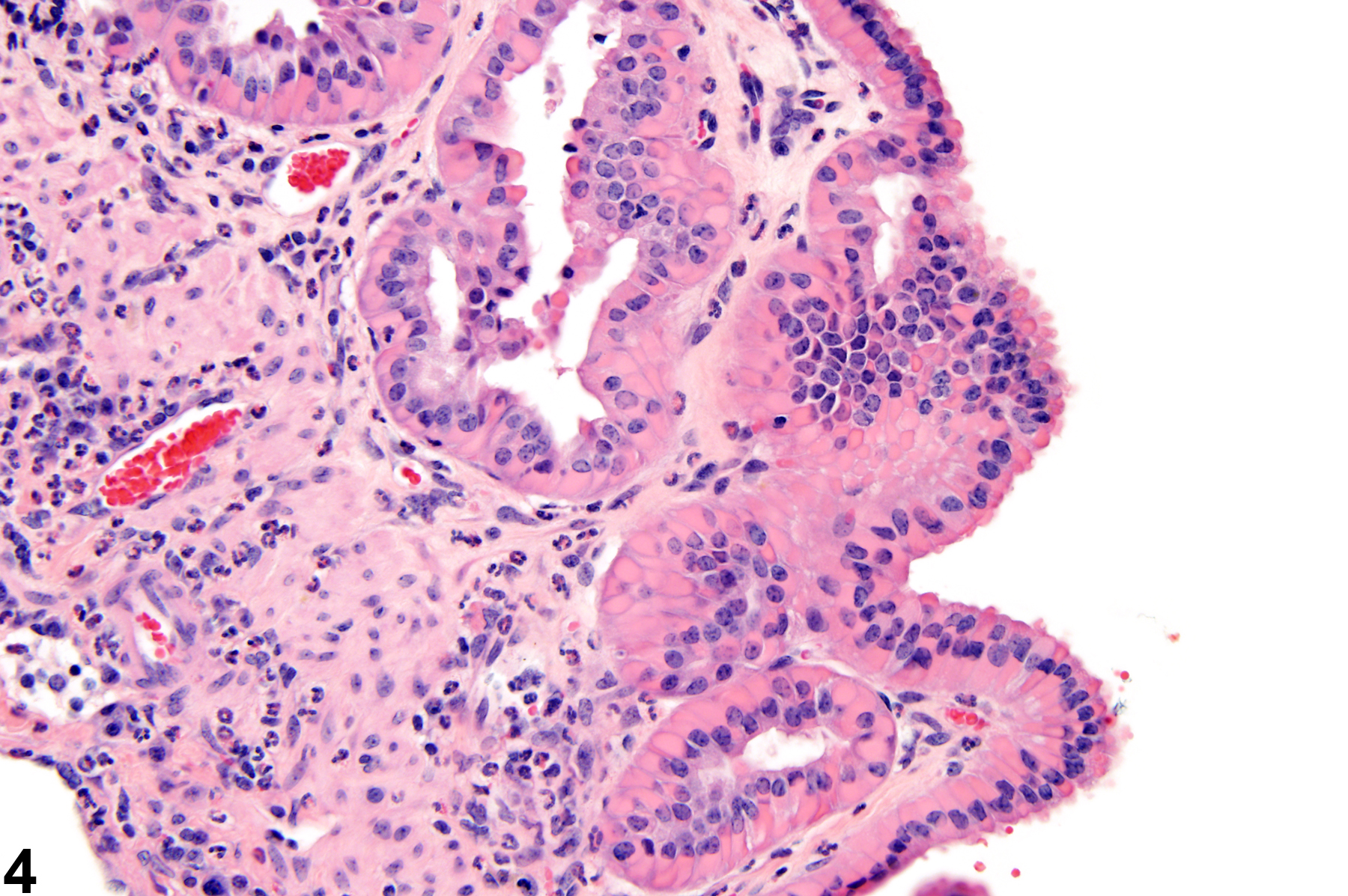 Image of inflammation in the gallbladder from a male  B6C3F1 mouse in a chronic study