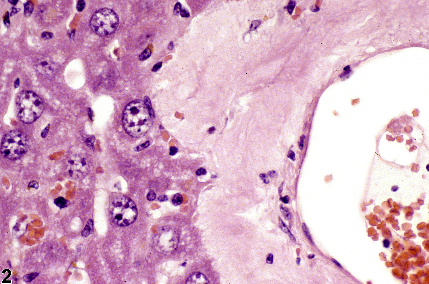 Image of amyloid in the liver from a male  Swiss Webster mouse in a chronic study