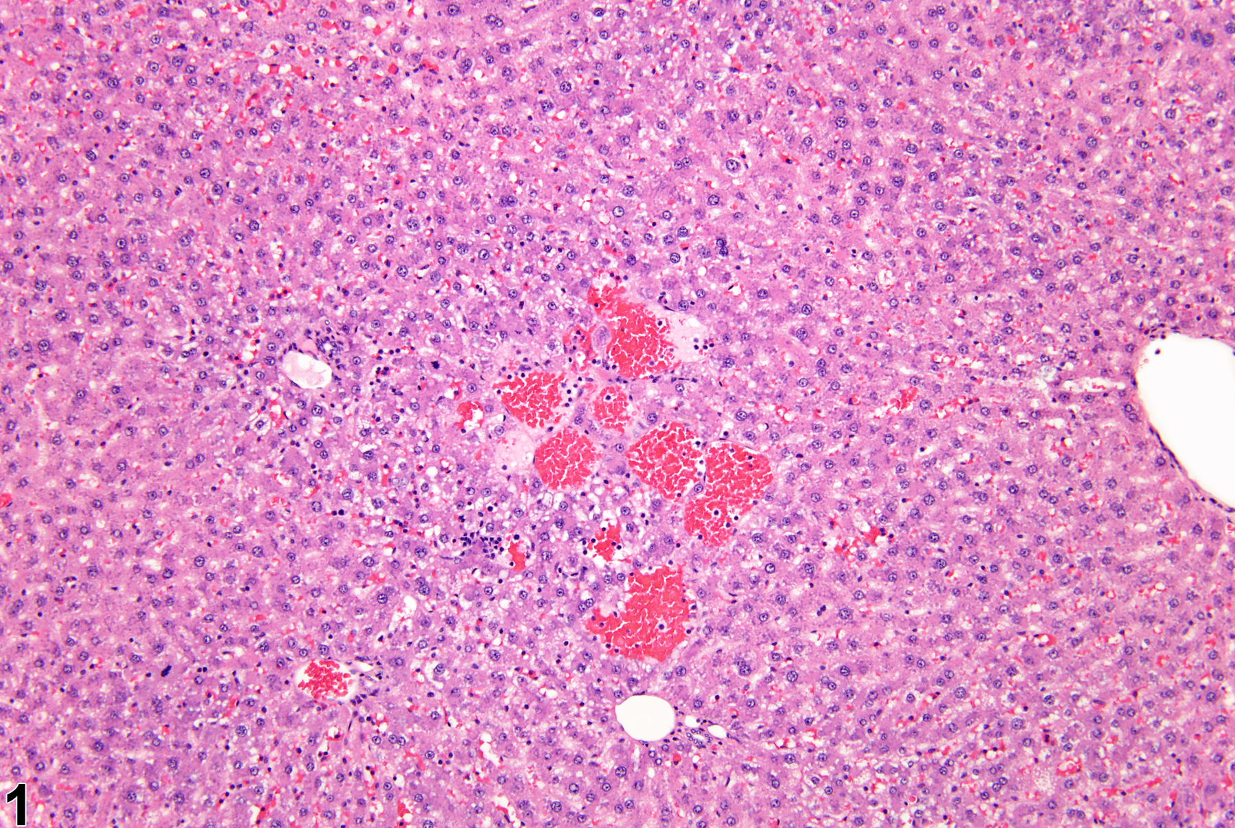 Image of angiectasis in the liver from a female F344/N rat in a chronic study