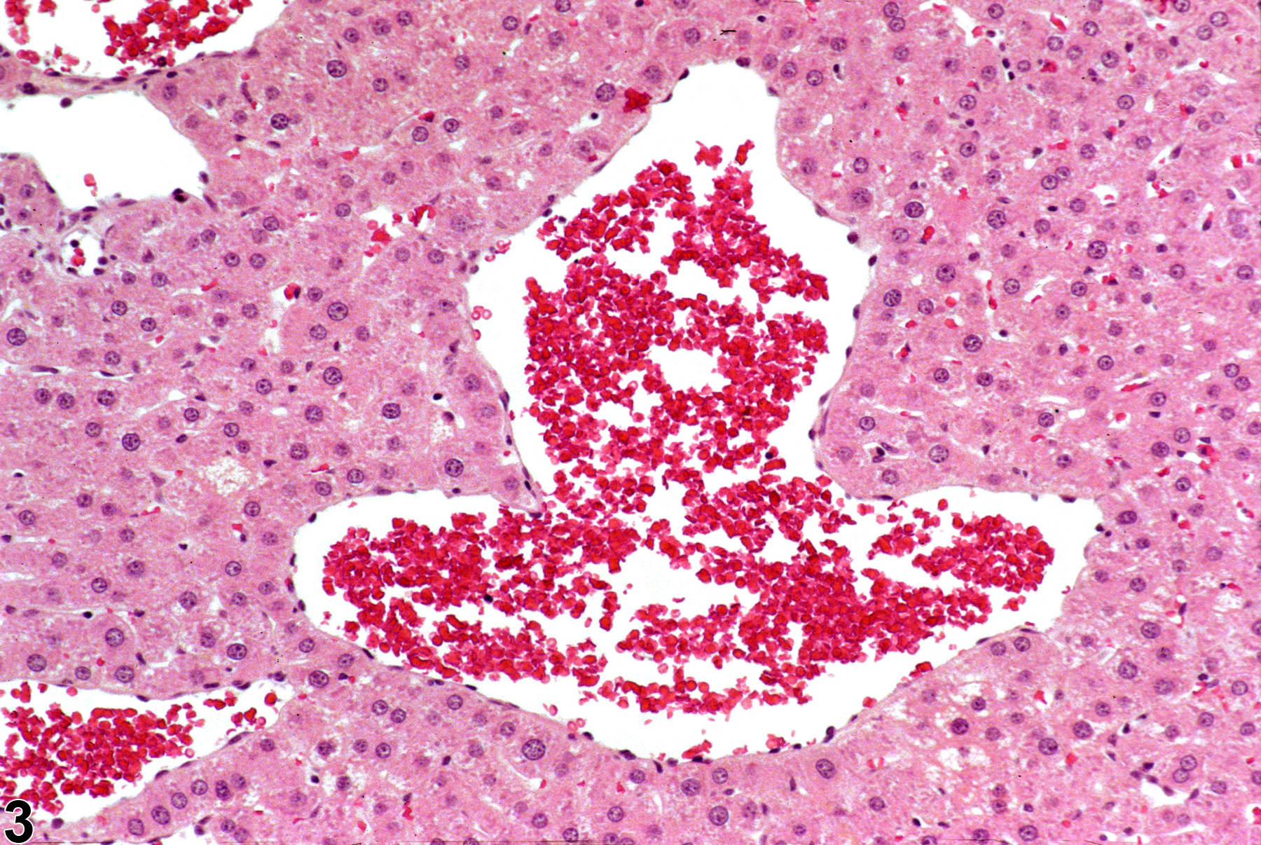 Image of angiectasis in the liver from a female F344/N rat