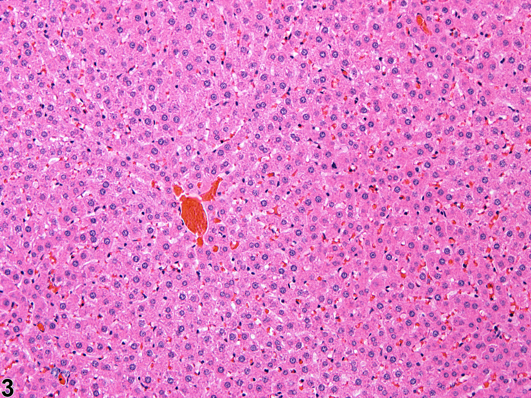 Image of atrophy (normal comparison) in the liver from a female F344/N rat in a subchronic study