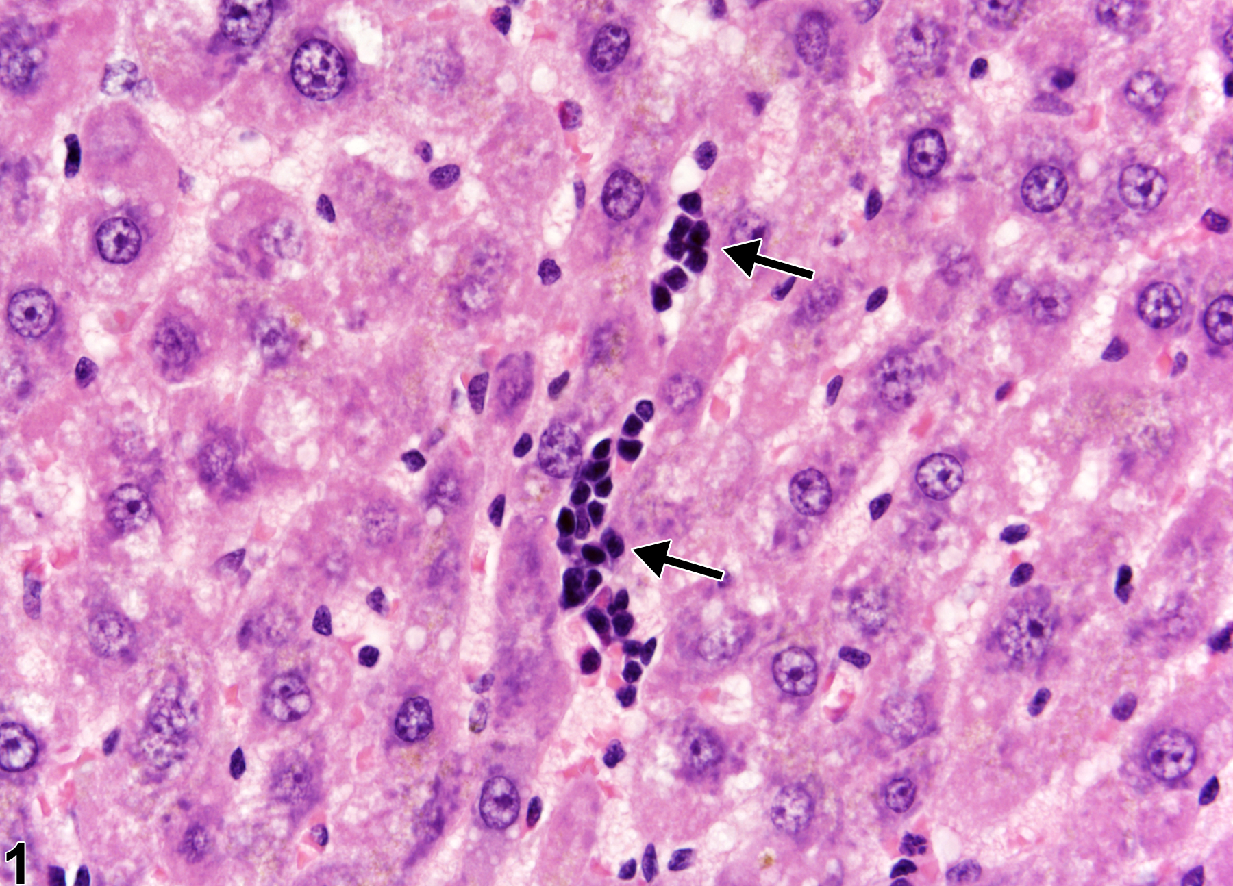 Image of extramedullary hematopoiesis in the liver from a female Harlan Sprague-Dawley rat in a chronic study