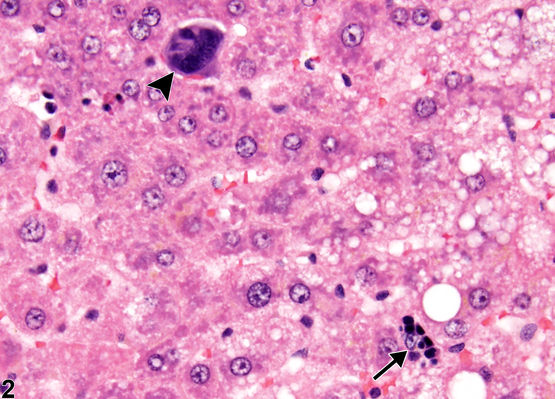 Image of extramedullary hematopoiesis in the liver from a female Harlan Sprague-Dawley rat in a chronic study