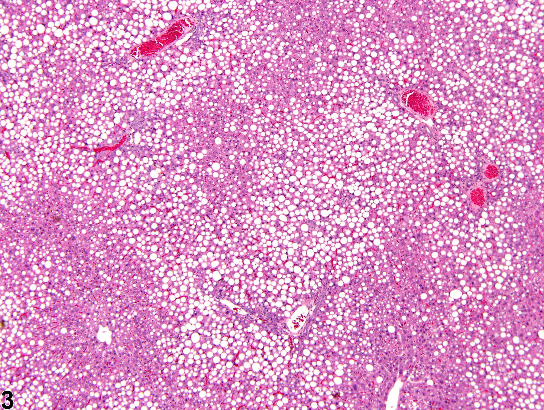 Image of fatty change in the liver from a male  F344/N rat in a chronic study