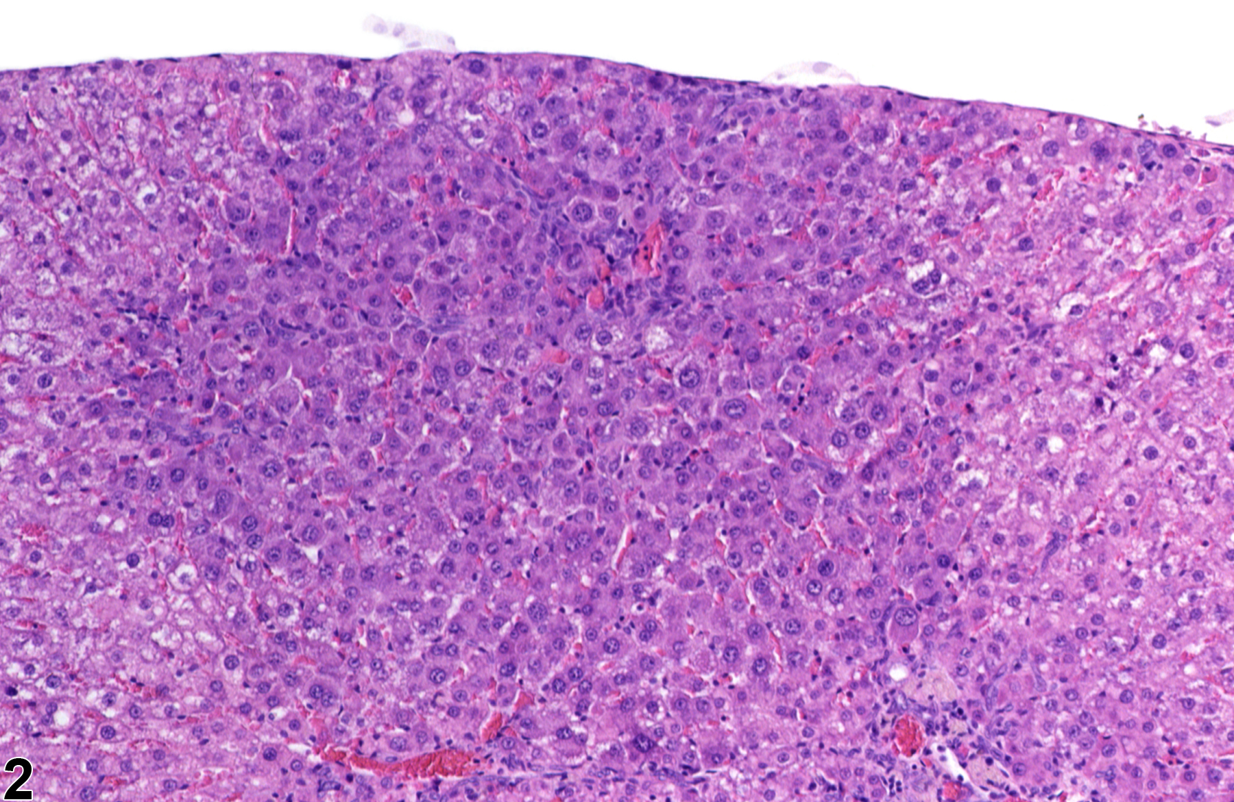 Image of basophilic focus in the liver from a male  F344/N rat in a subchronic study