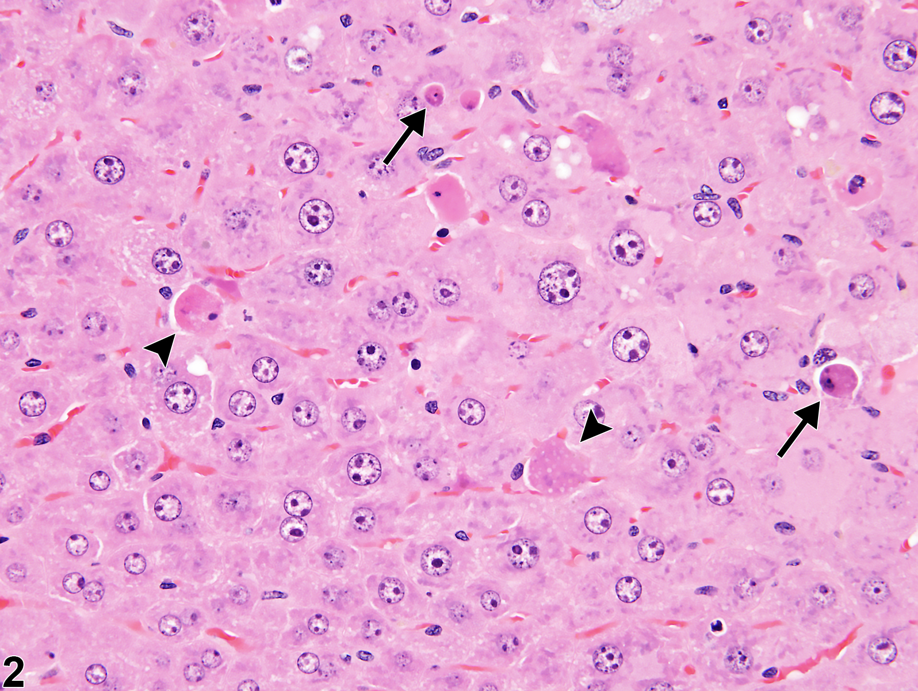Image of apoptosis in the liver from a male B6C3F1/N mouse in a chronic study