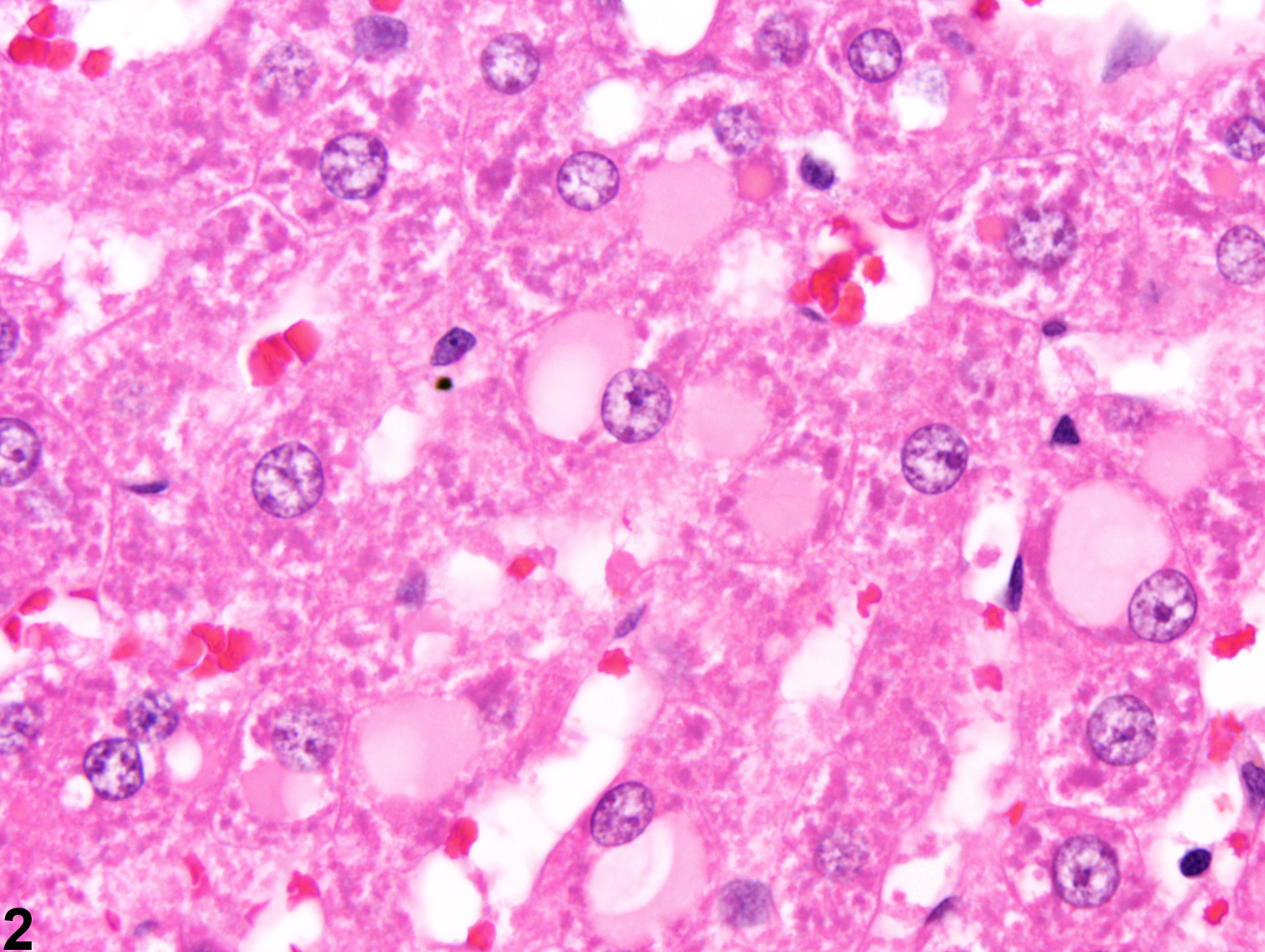 Image of cytoplasmic inclusions in the liver from a male  F344/N rat in a subchronic study
