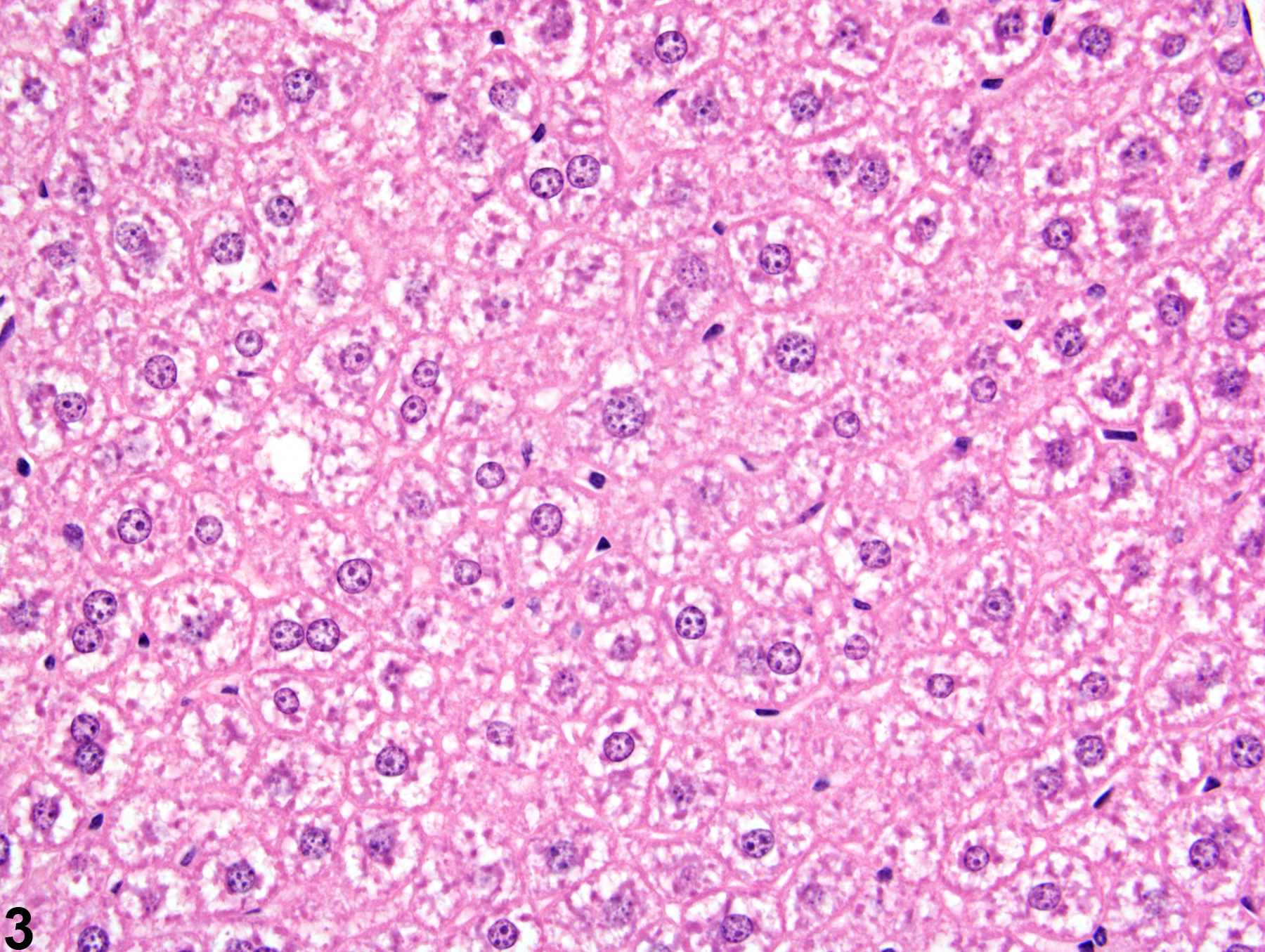 Image of glycogen accumulation in the liver from a male B6C3F1 mouse in a subchronic study