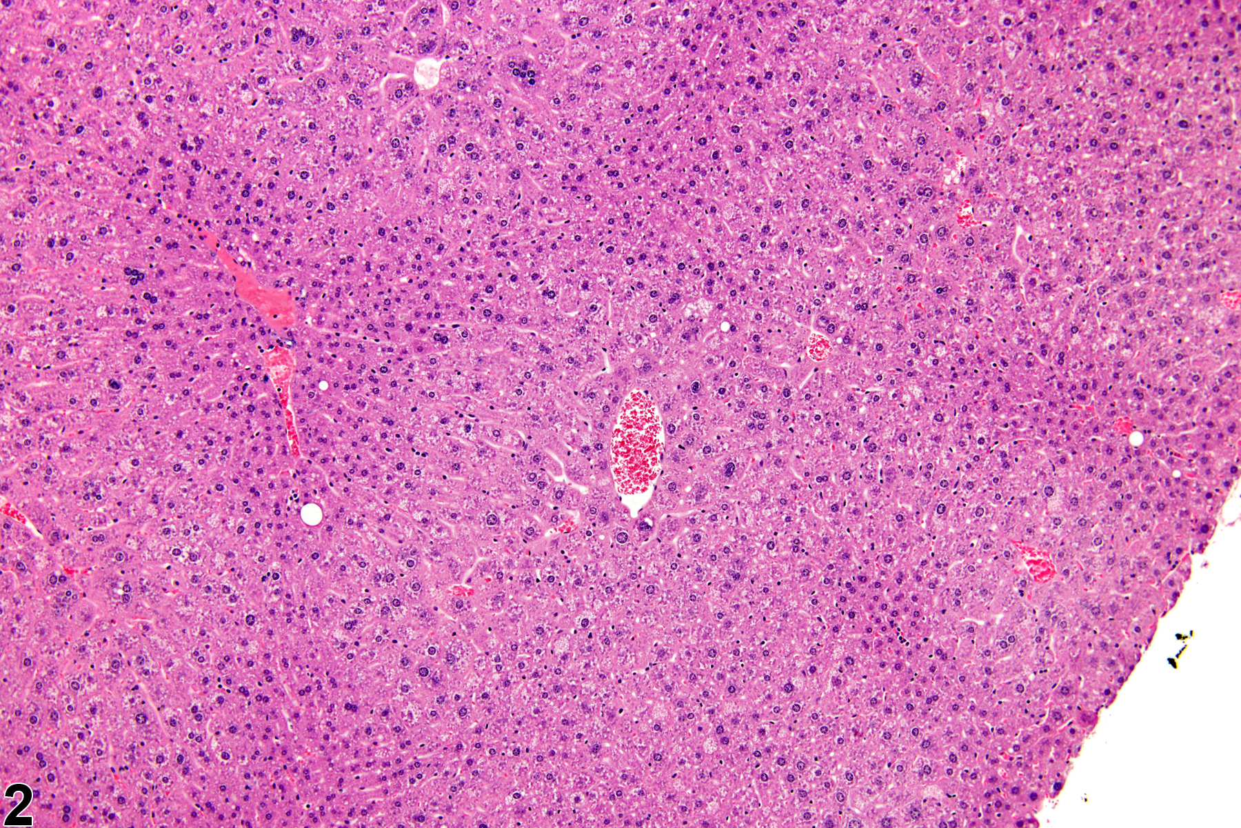 Image of hypertrophy in the liver from a male  B6C3F1 mouse in a chronic study