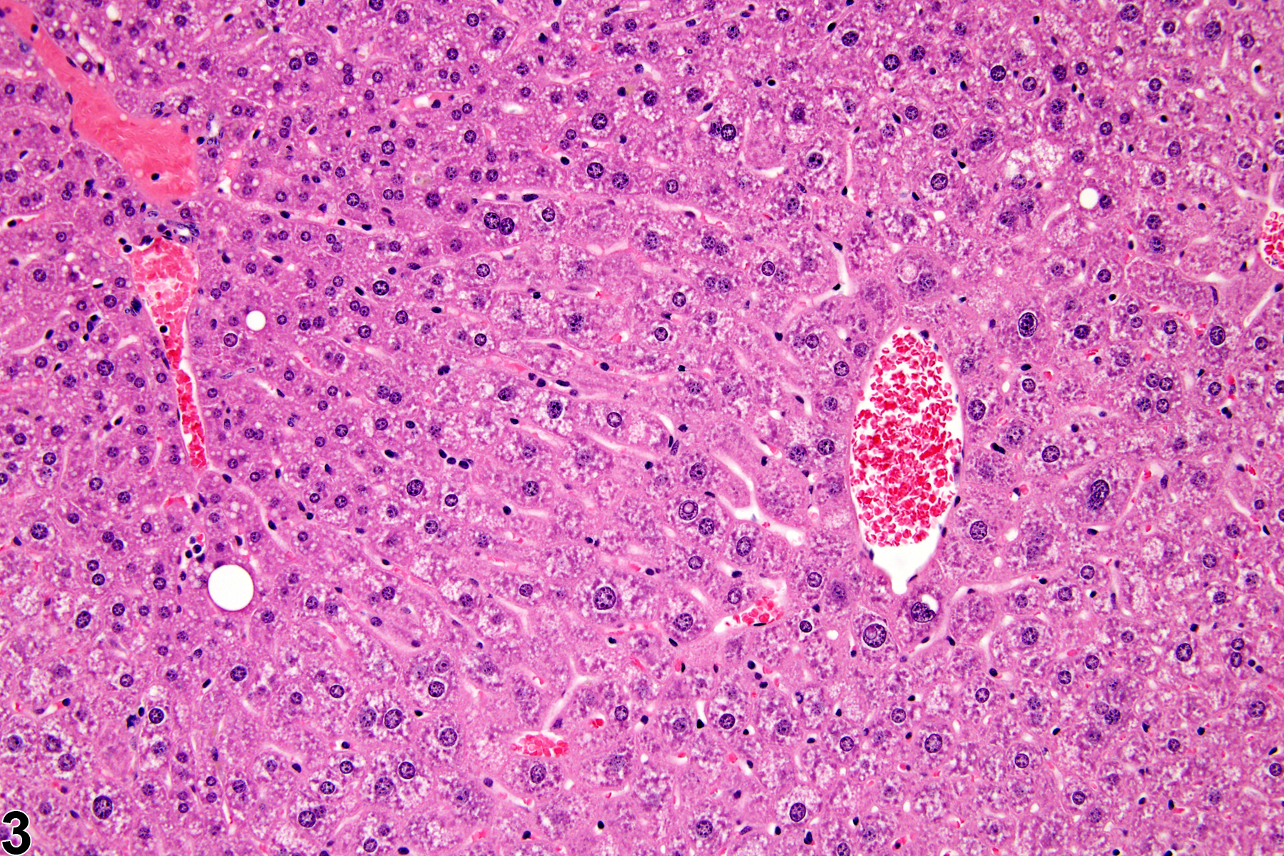 Image of hypertrophy in the liver from a male  B6C3F1 mouse in a chronic study