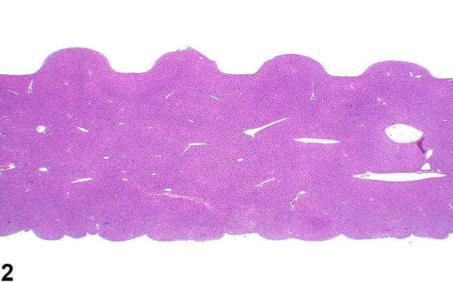 Image of artifact showing impression of tissue cassette on natural surfaces in the liver