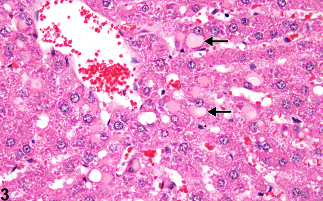 Image of postmortem occurring cytoplasmic vacuoles containing eosinophilic material in the liver from a male F344/N rat in a subchronic study