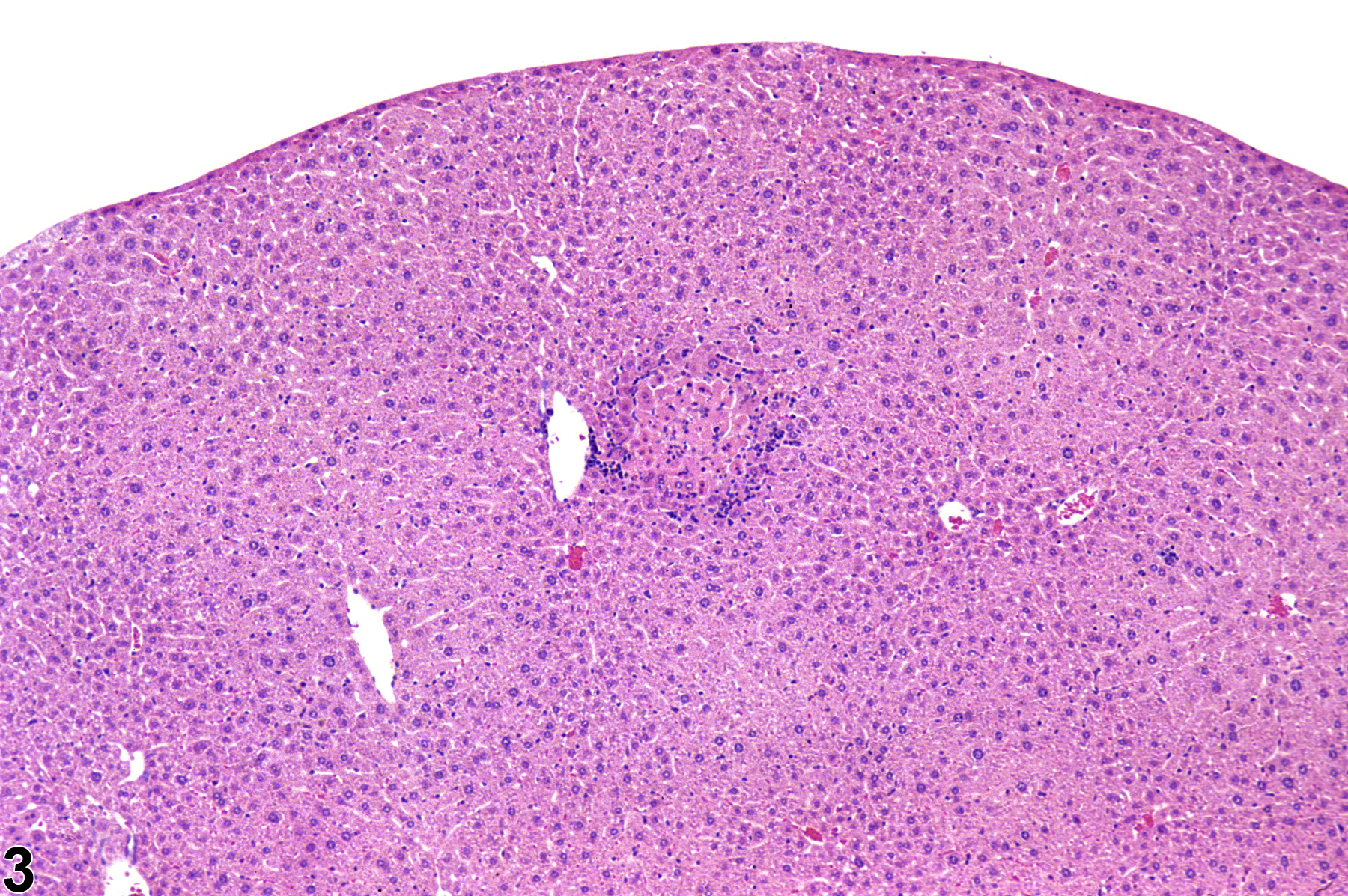 Image of inflammation in the liver from a female Swiss Webster mouse in a subchronic study