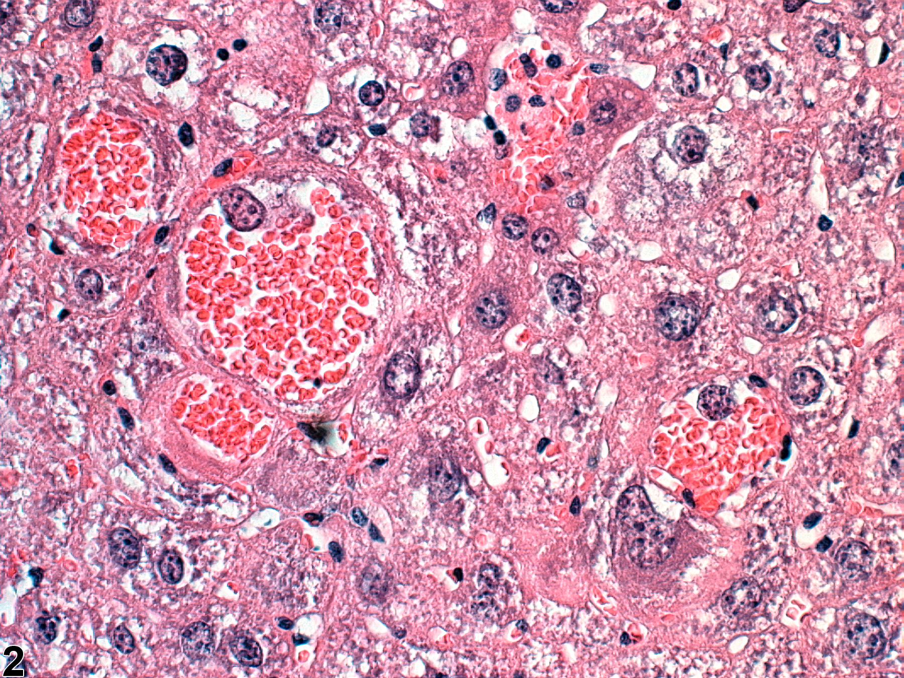 Image of Intrahepatocellular erythrocytes in the Liver from a Male  B6C3F1 Mouse in a 2 year  Study