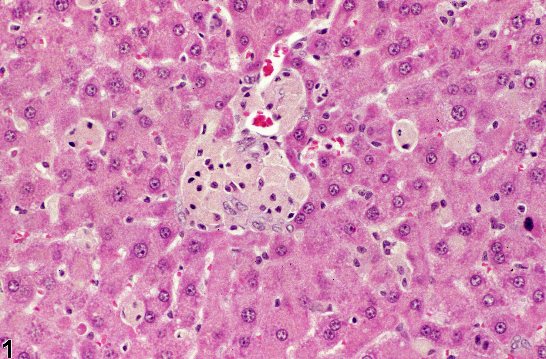 Image of Kupffer cell hyperplasia in the liver from a female F344/N rat in a subchronic study