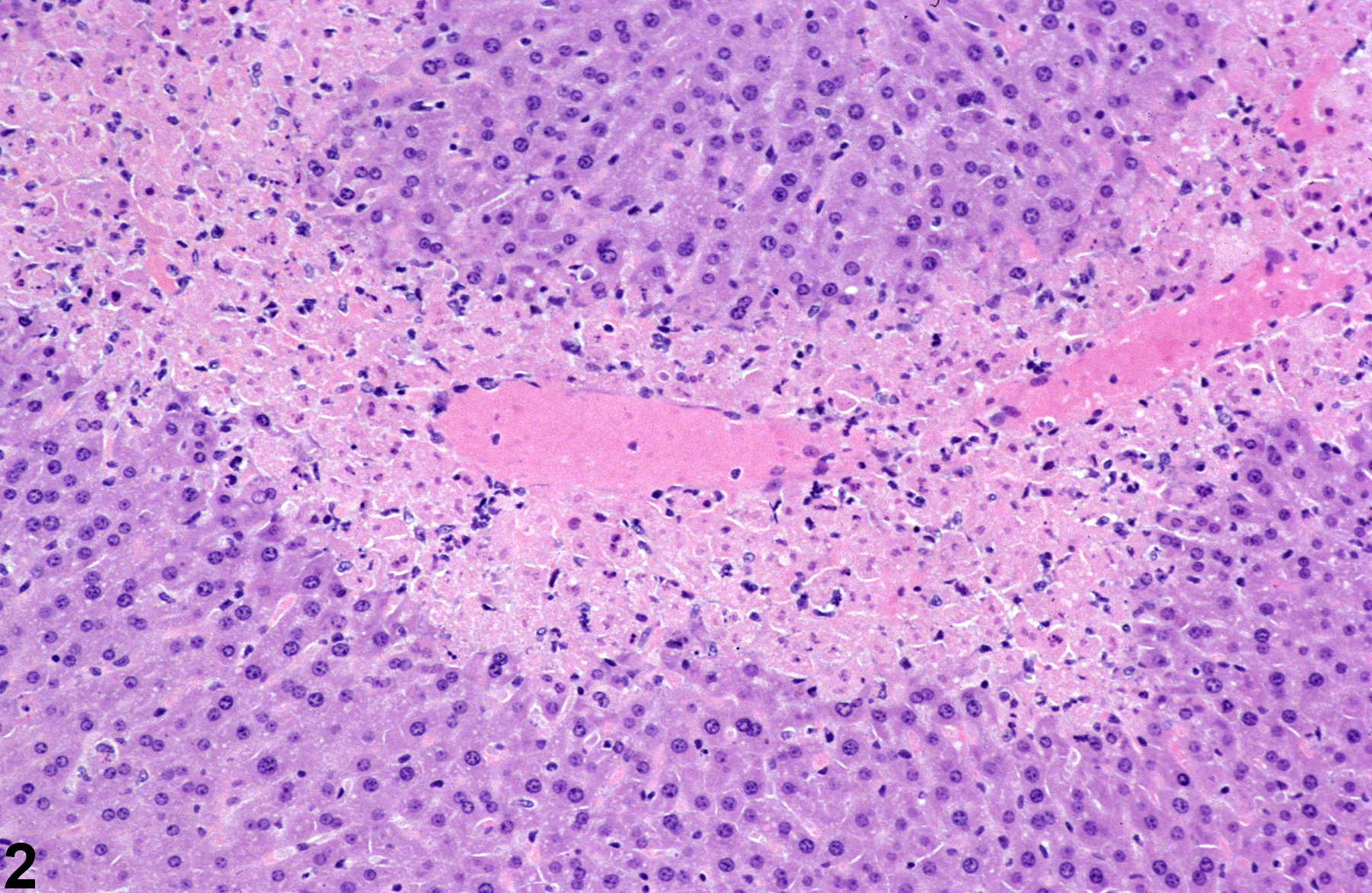 Image of necrosis in the liver from a male B6C3F1 mouse in a subchronic study