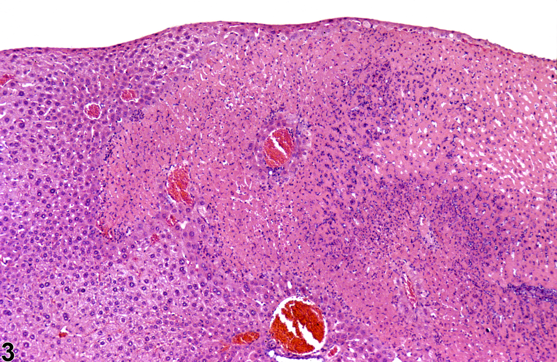 Image of necrosis in the liver from a female Swiss Webster mouse in a subchronic study