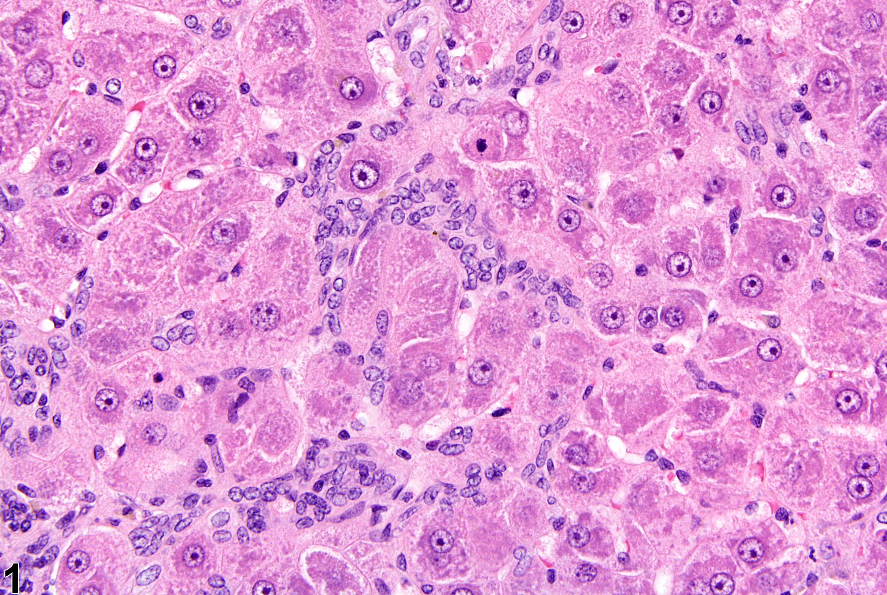 Image of hyperplasia in the liver from a female Harlan Sprague-Dawley rat in a chronic study