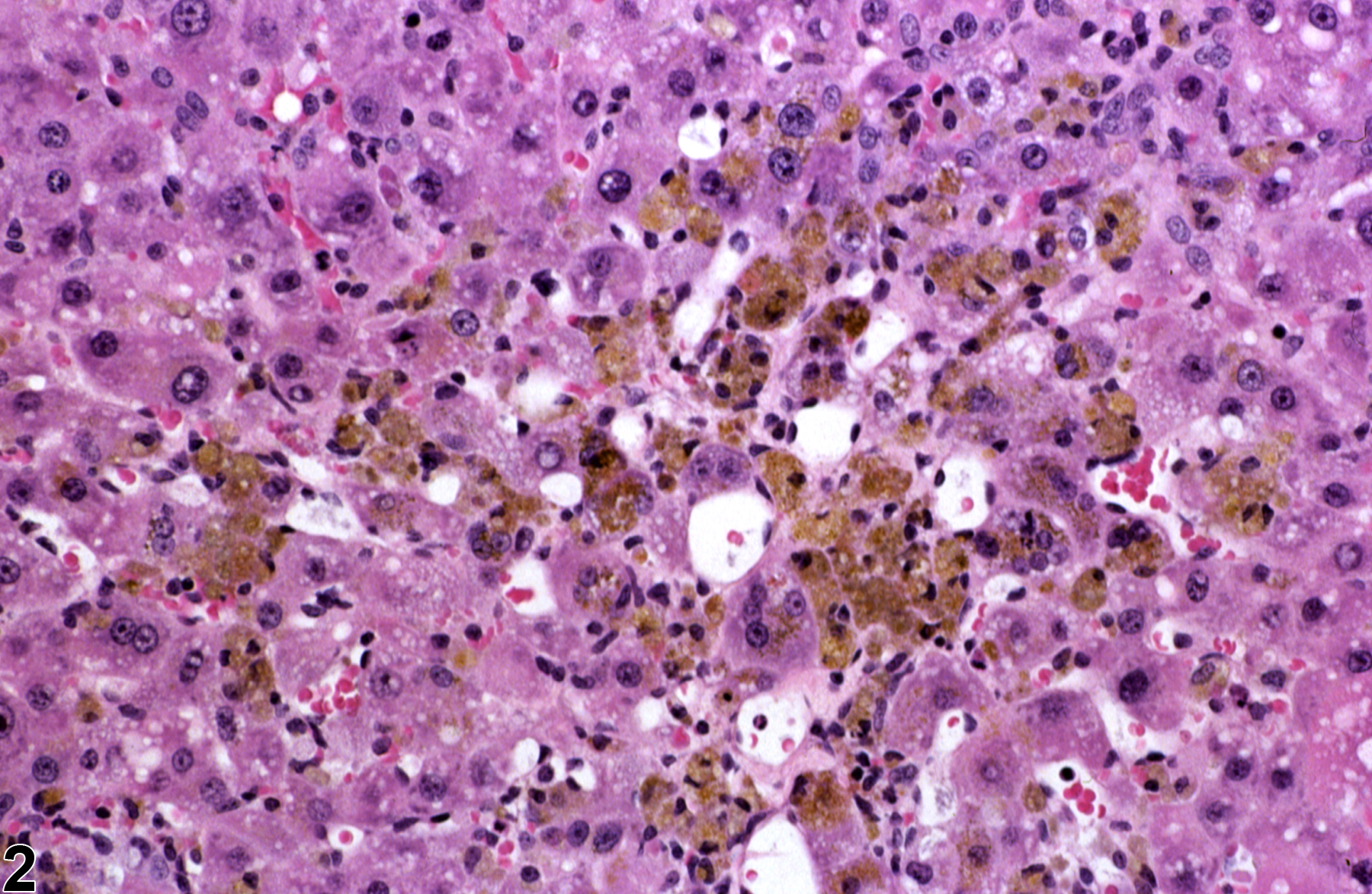 Image of pigment in the liver from a female Harlan Sprague-Dawley rat in a chronic study