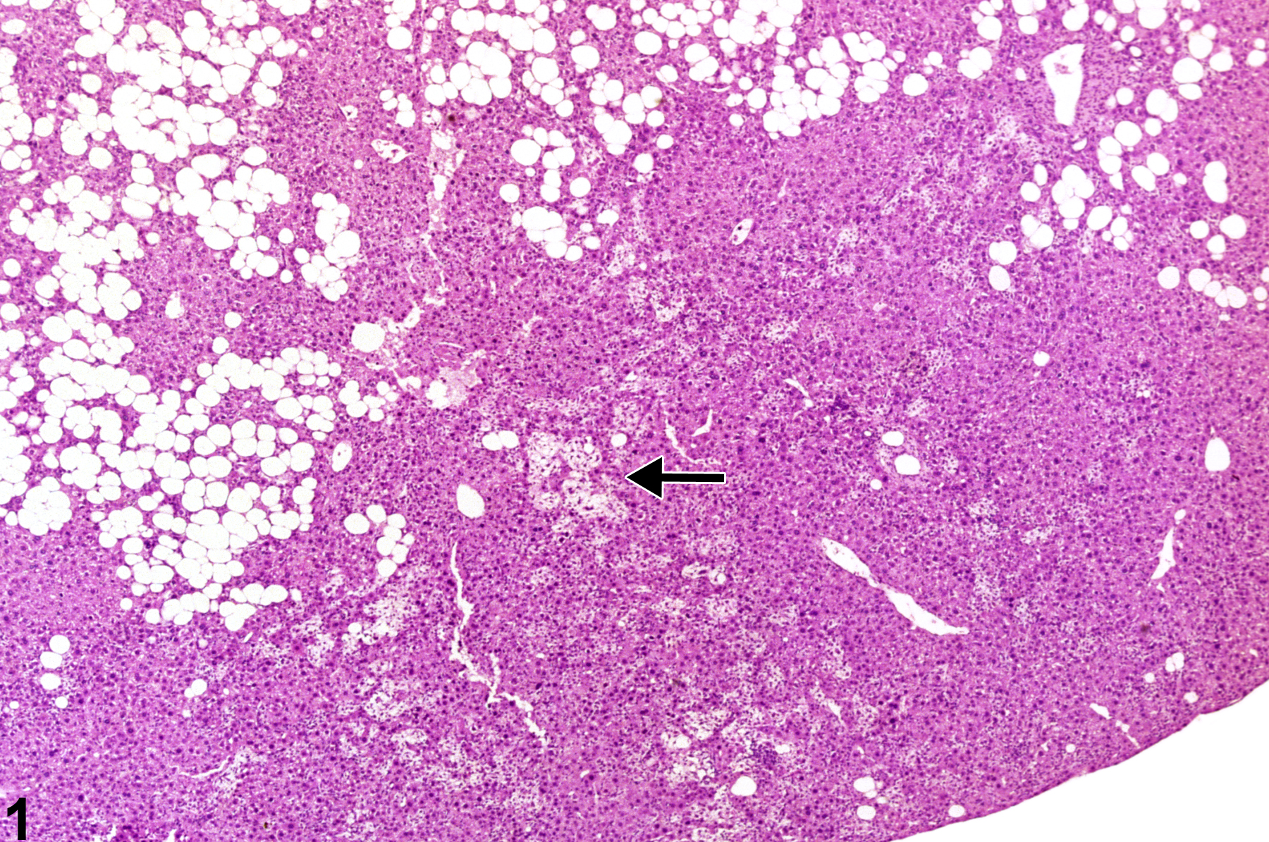 Image of hyperplasia in the liver from a female B6C3F1 mouse in a chronic study