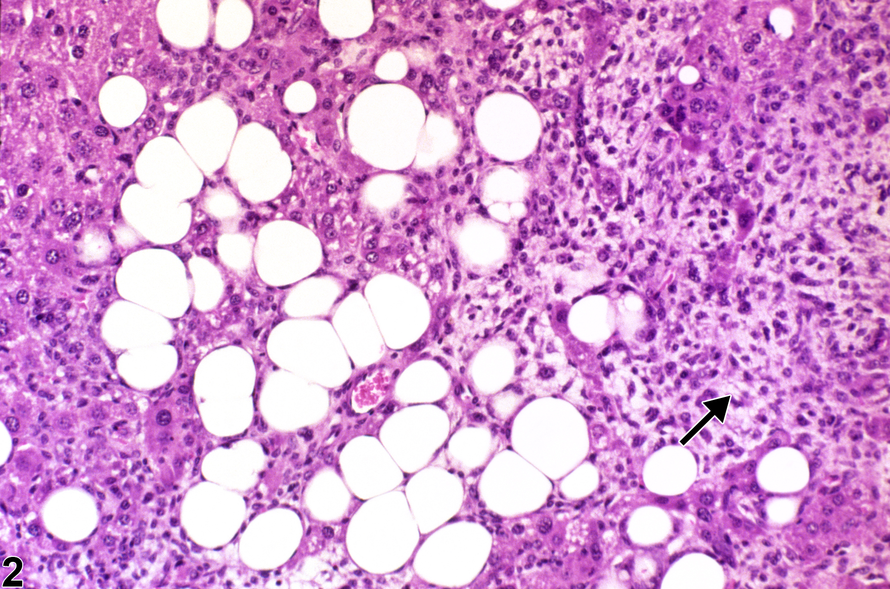 Image of hyperplasia in the liver from a female B6C3F1 mouse in a chronic study