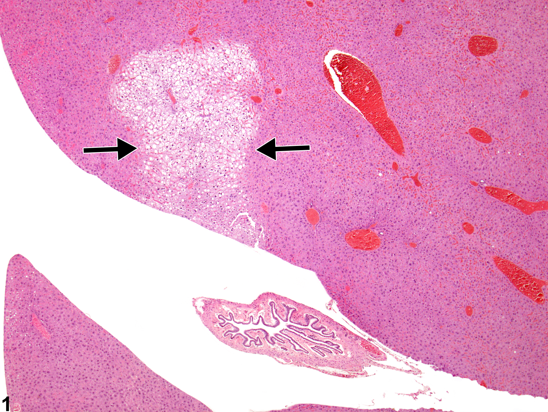 Image of tension lipidosis in the liver from a male B6C3F1 mouse in a chronic study