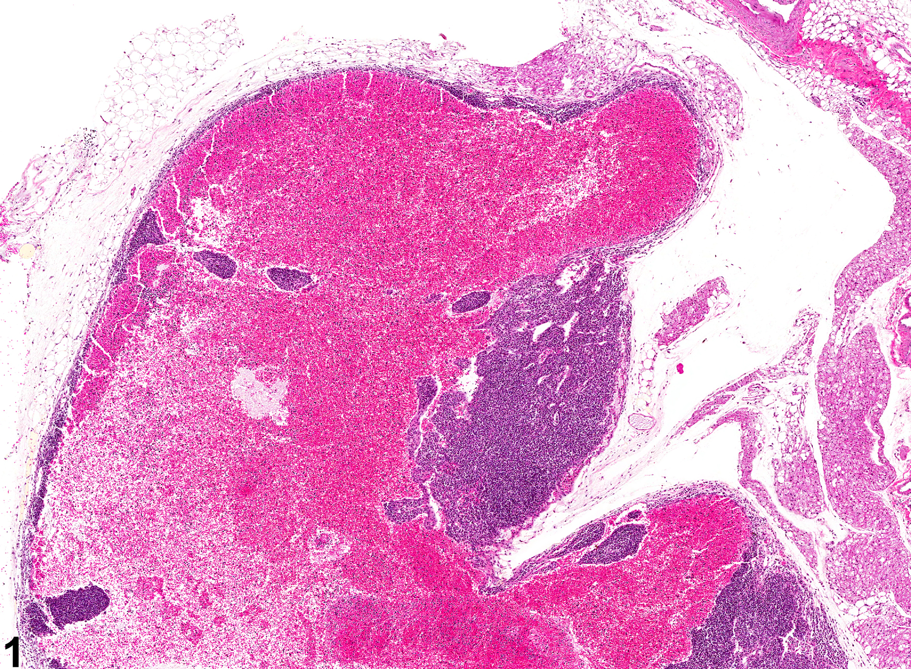 Image of angiectasis in the lymph node from a female B6C3F1/N mouse in a chronic study