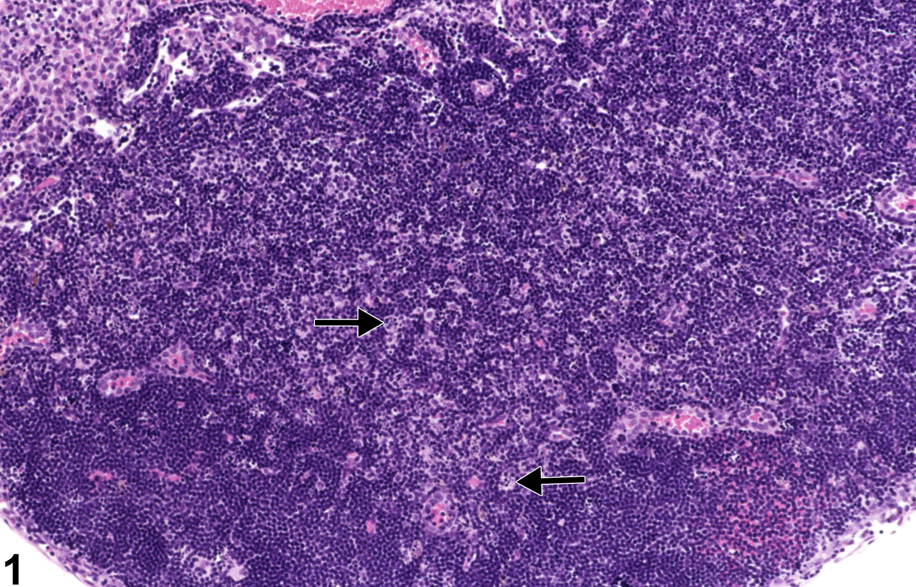 Image of apoptosis, lymphocyte in the lymph node from a female B6C3F1/N mouse in a subchronic study