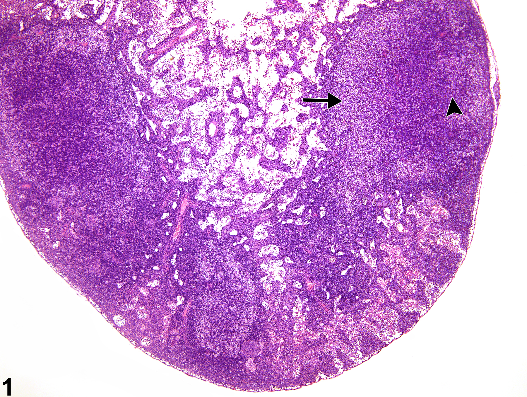 Image of atrophy in the lymph node from a female F344/N rat in a subchronic study
