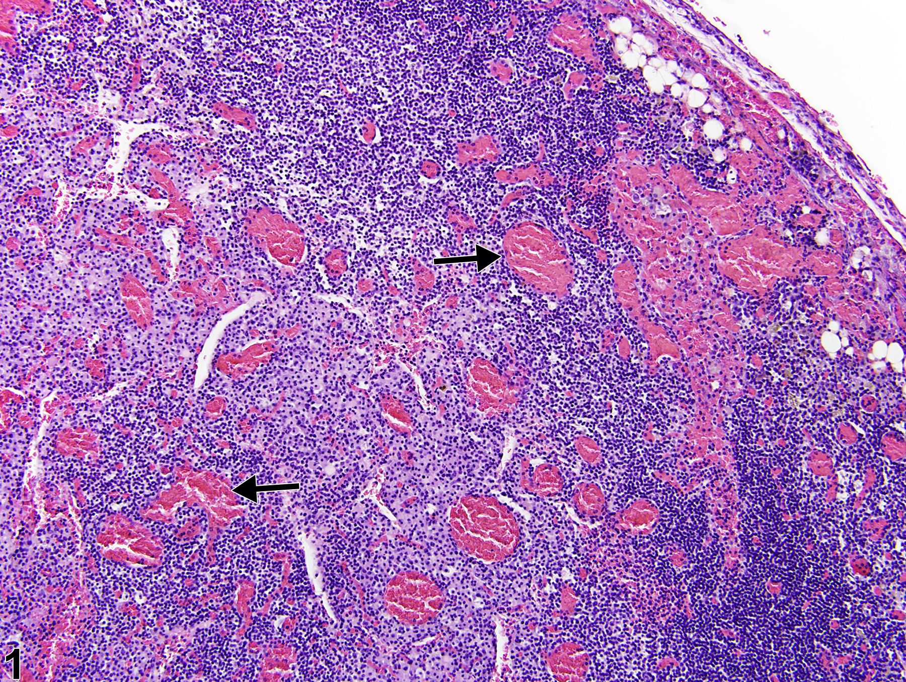 Image of congestion in the lymph node from a female B6C3F1/N mouse in a chronic study