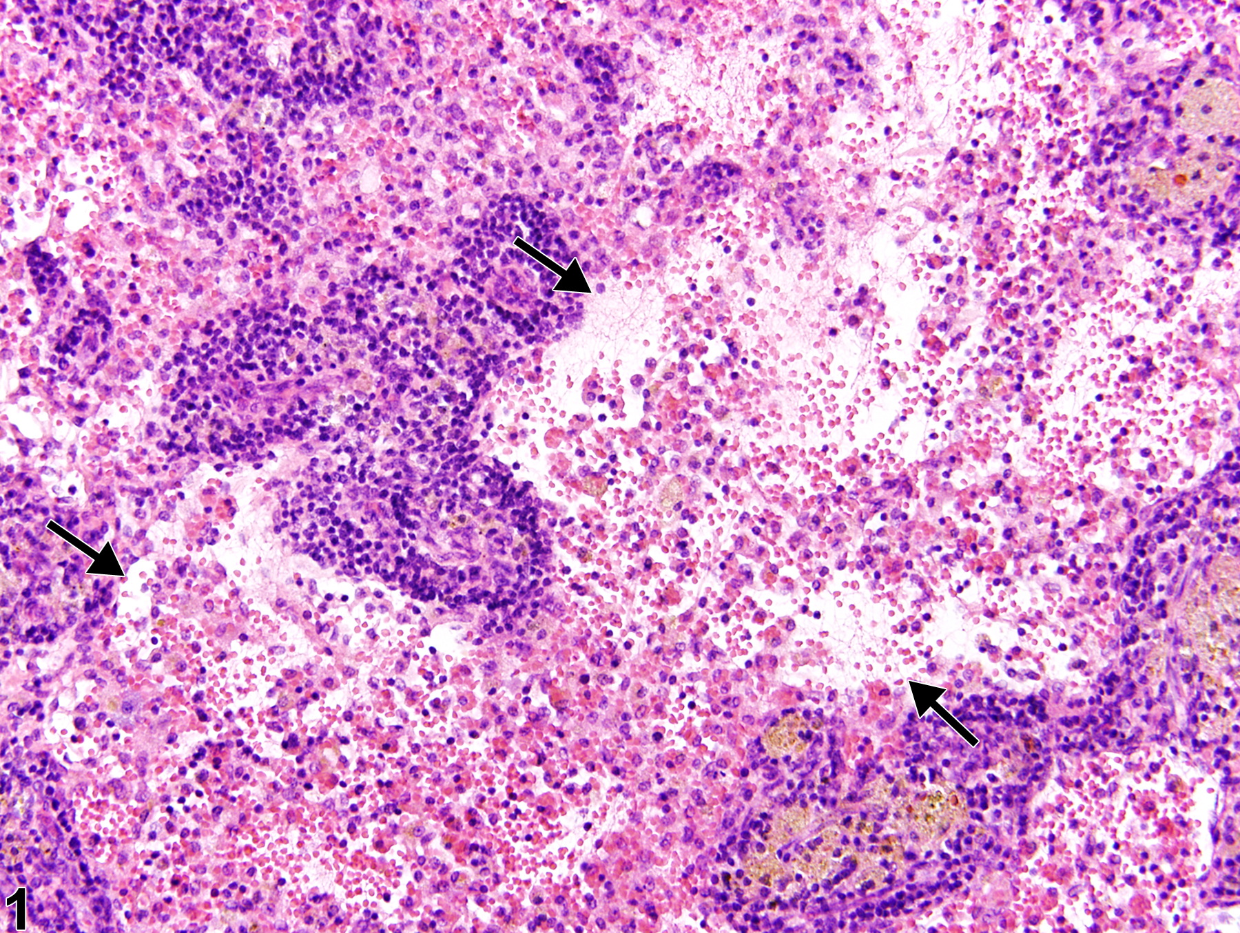 Image of erythrophagocytosis in the lymph node from a female F344/N rat in a chronic study