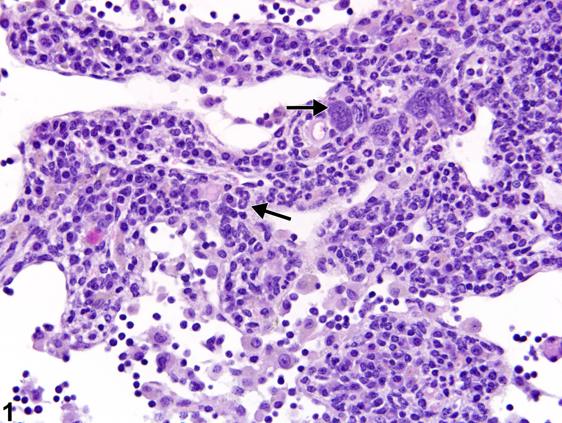 Image of extramedullary hematopoiesis in the lymph node from a female B6C3F1/N mouse in a chronic study