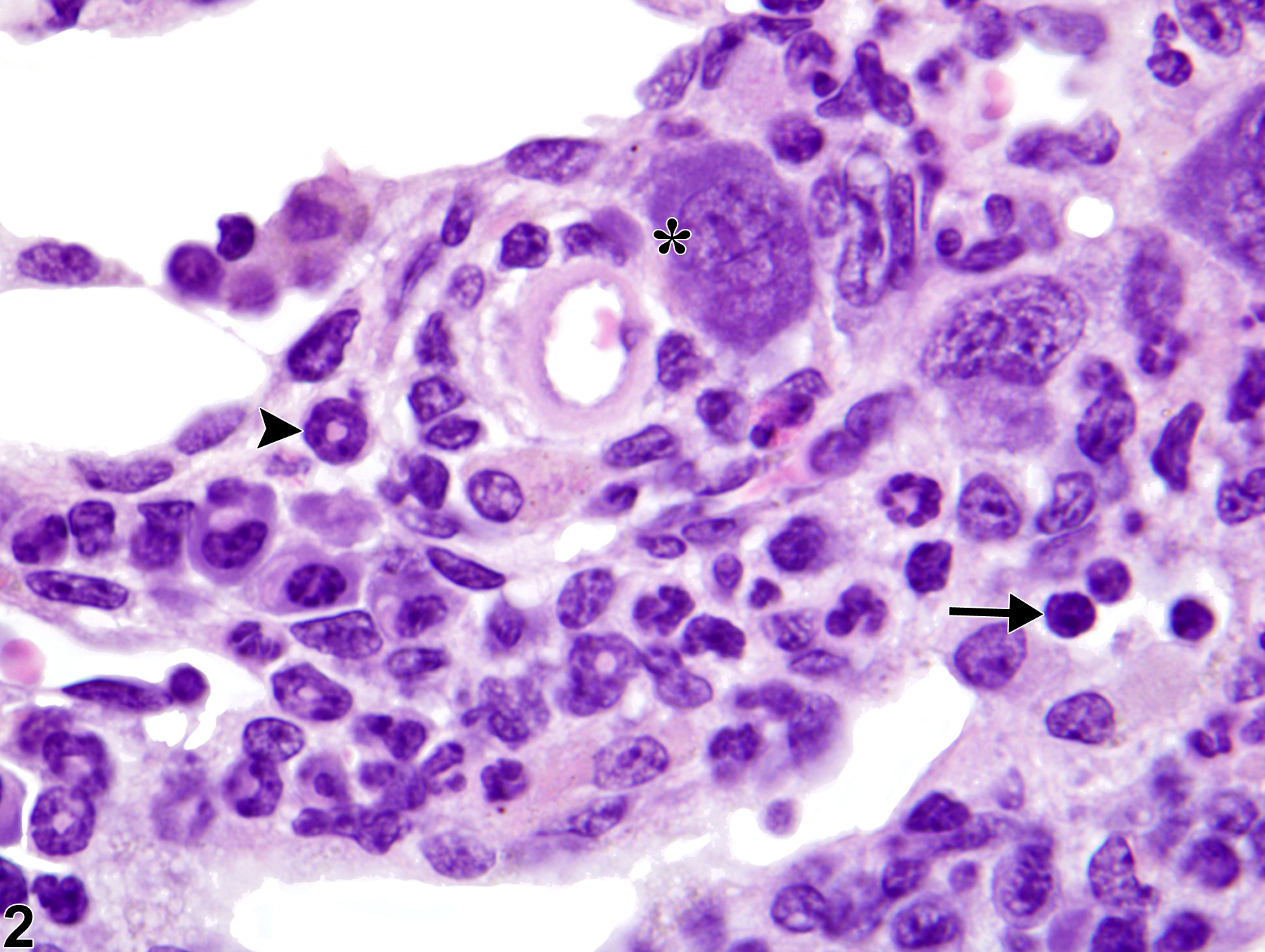 Image of extramedullary hematopoiesis in the lymph node from a female B6C3F1/N mouse in a chronic study