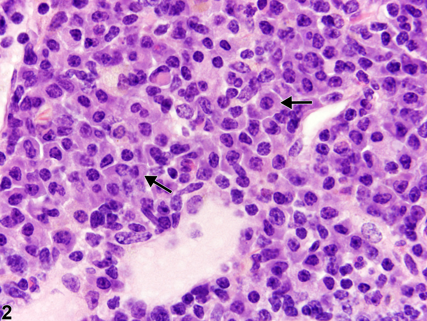 Image of hyperplasia, plasma cell in the lymph node from a female B6C3F1/N mouse in a chronic study