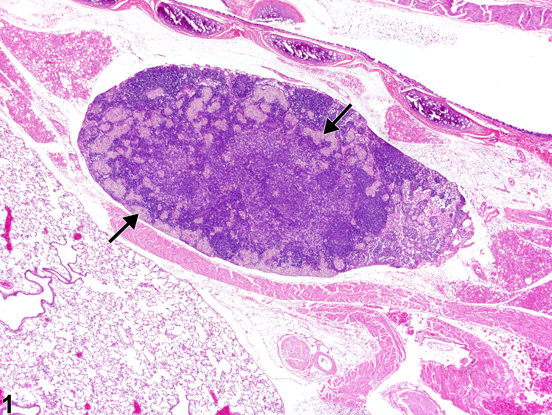 Image of infiltrate, cellular, histiocyte in the lymph node from a male Harlan Sprague-Dawley rat in a subchronic study
