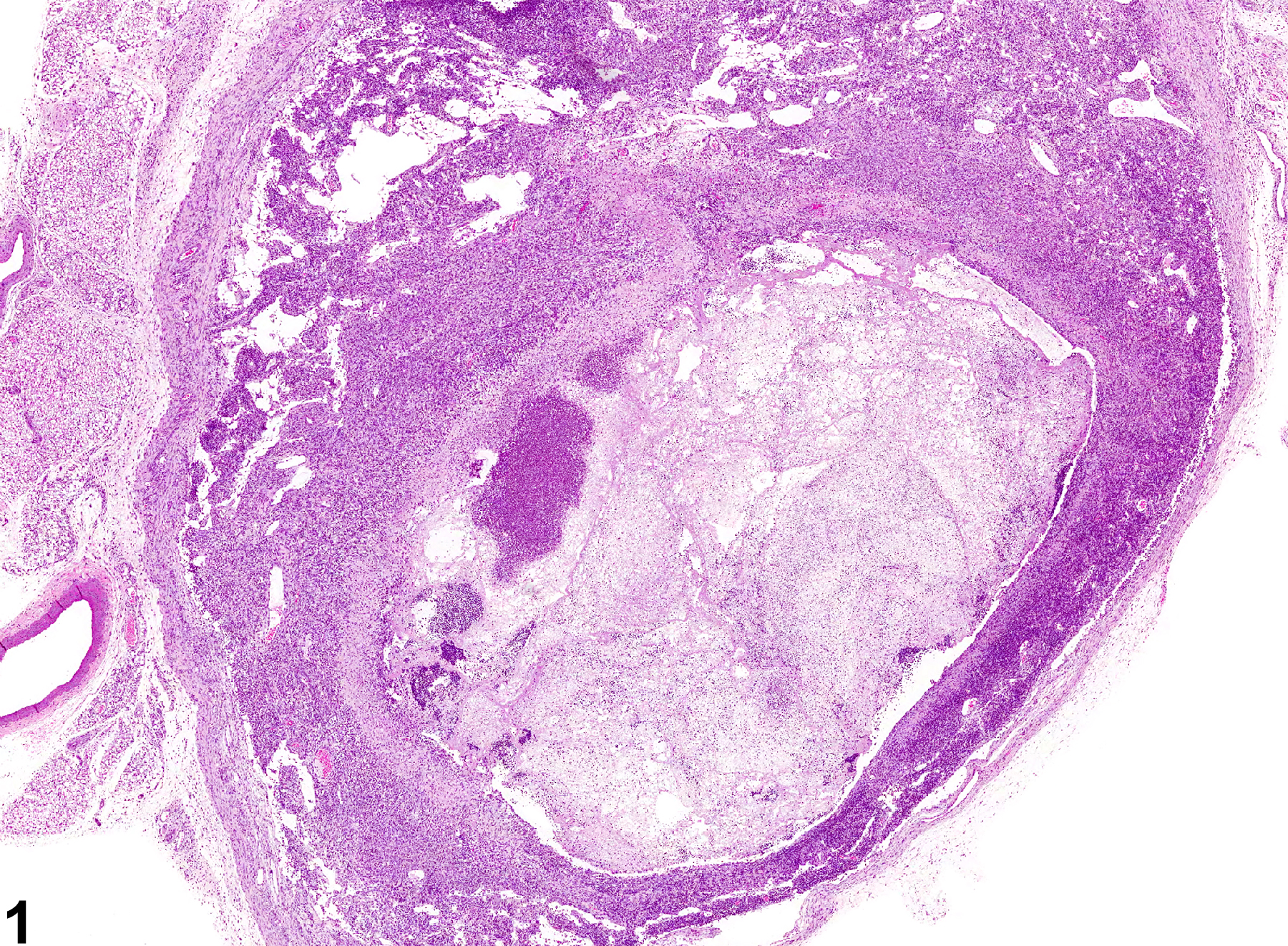 Image of inflammation in the lymph node from a male F344/N rat in a chronic study