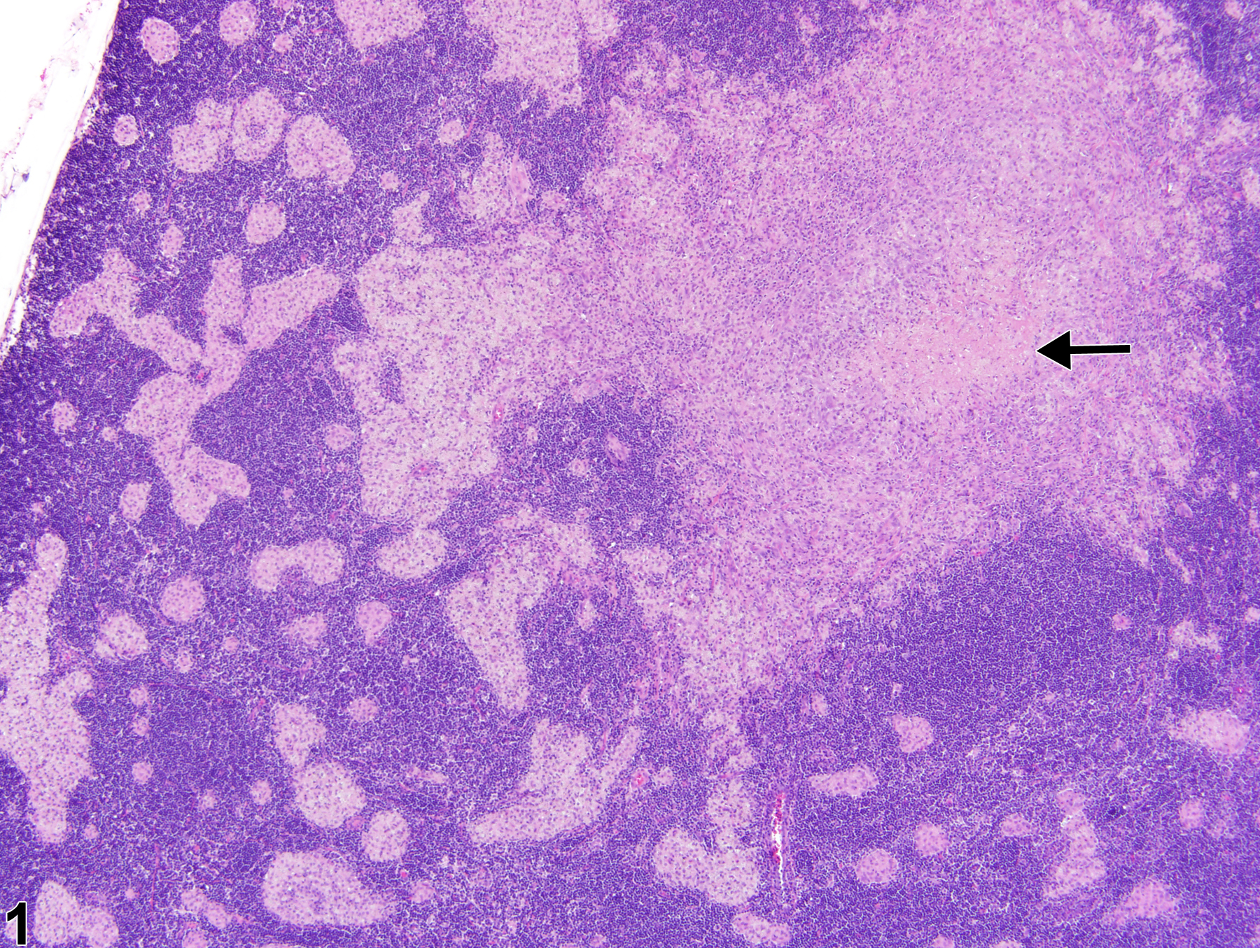 Image of necrosis in the lymph node from a male Harlan Sprague-Dawley rat in a subchronic study
