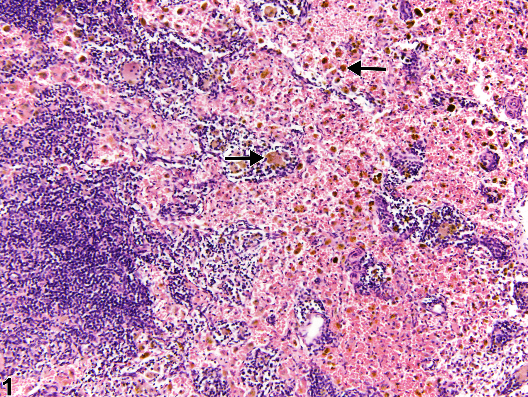 Image of pigment in the lymph node from a male Harlan Sprague-Dawley rat in a chronic study