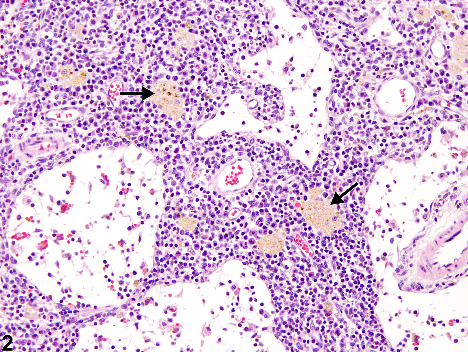 Image of pigment in the lymph node from a male F344/N rat in a chronic study