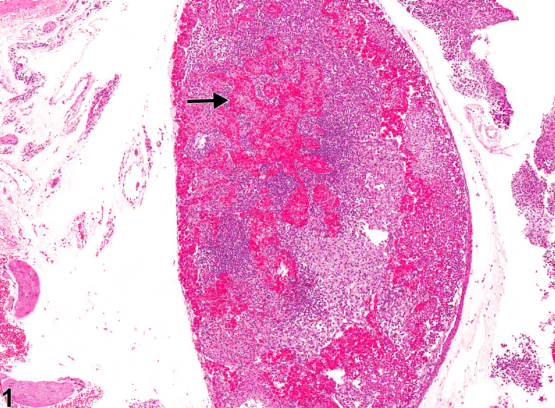 Image of sinus erythrocytosis in the lymph node from a female B6C3F1/N mouse in a chronic study