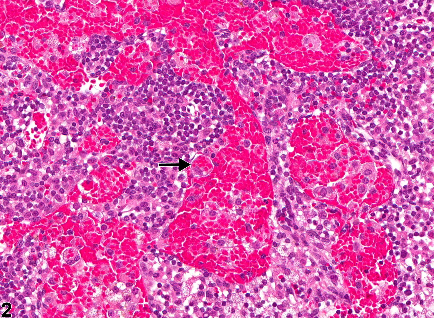Image of sinus erythrocytosis in the lymph node from a female B6C3F1/N mouse in a chronic study