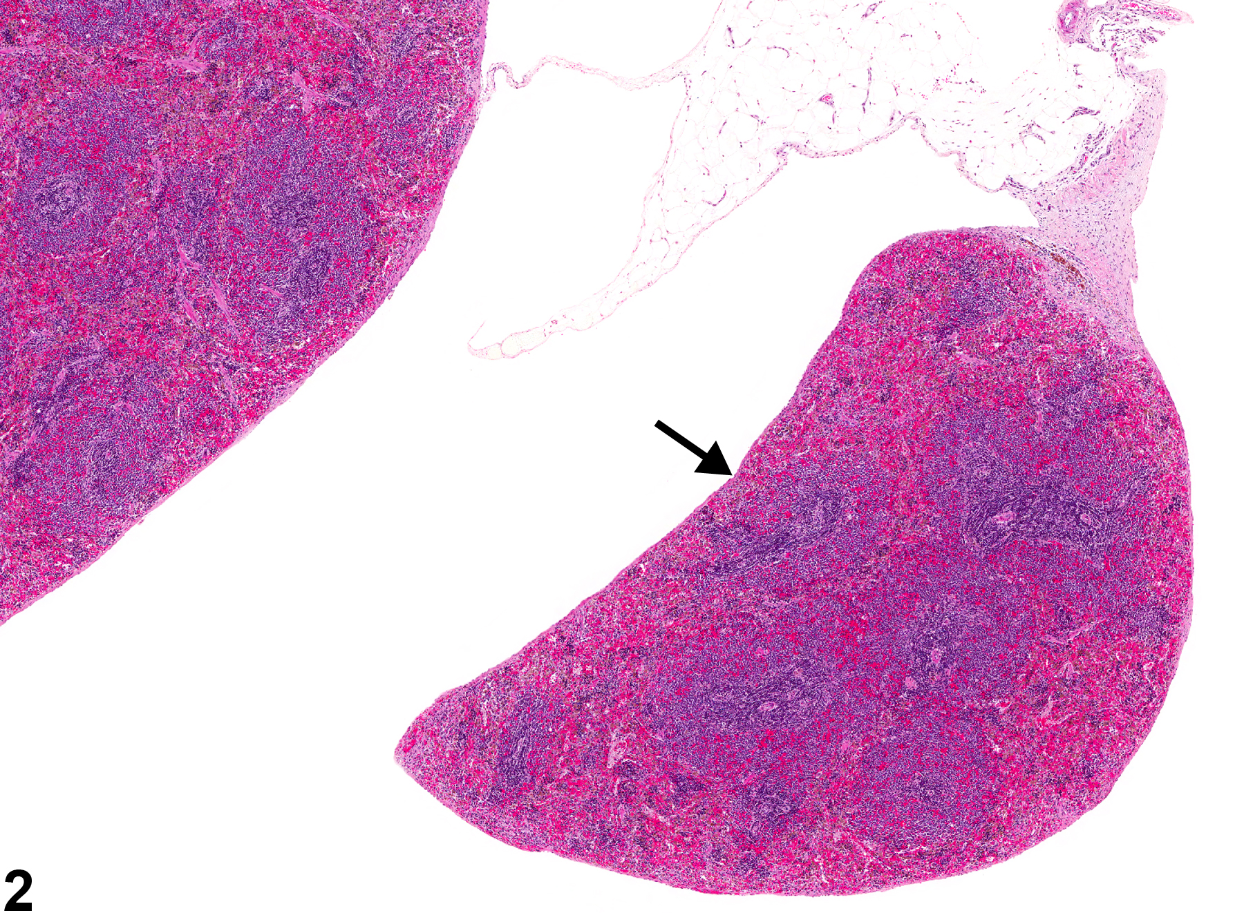 Image of accessory spleen in the spleen from a male B6C3F1/N mouse in a chronic study