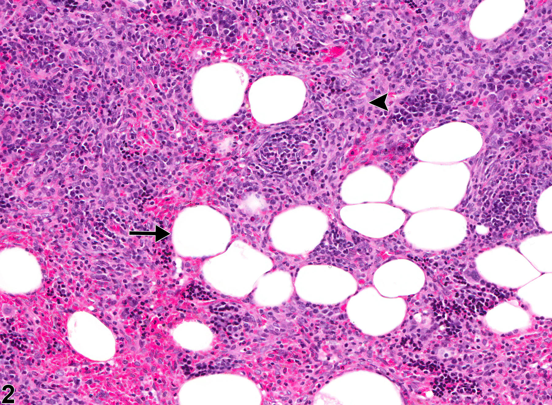 Image of adipocyte metaplasia in the spleen from a female F344/N rat in a chronic study