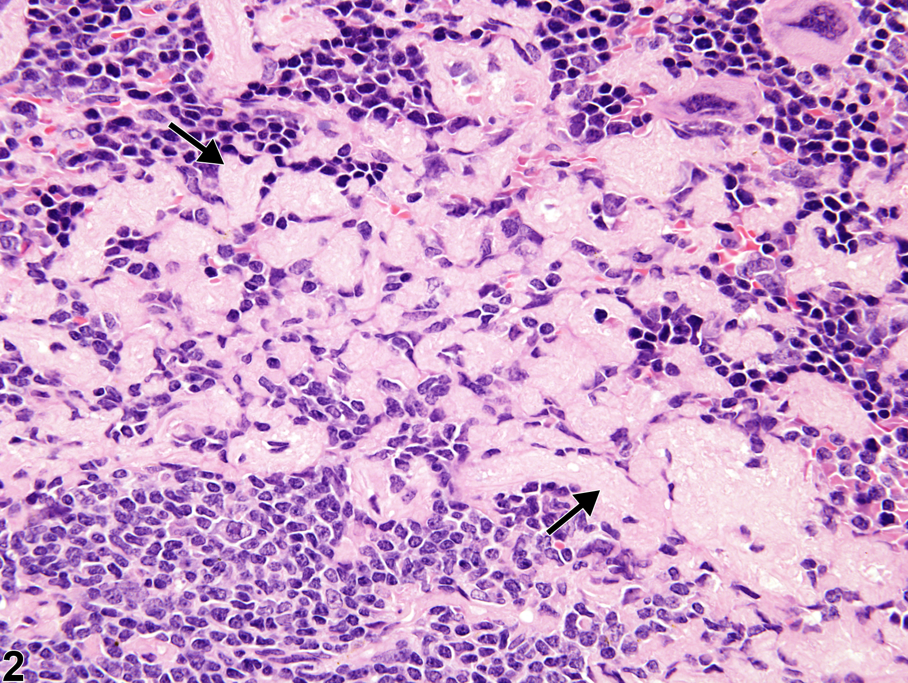 Image of amyloid in the spleen from a male B6C3F1/N mouse in a chronic study