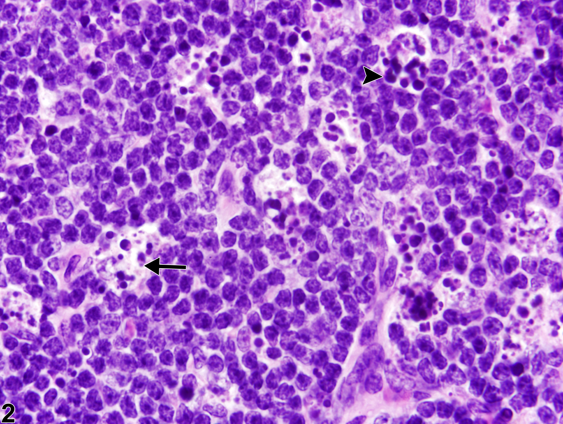 Image of apoptosis, lymphocyte in the spleen from a female B6C3F1/N mouse in a subchronic study
