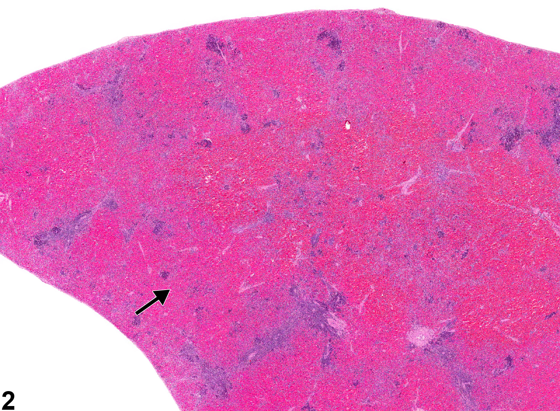Image of congestion in the spleen from a female F344/N rat in a chronic study