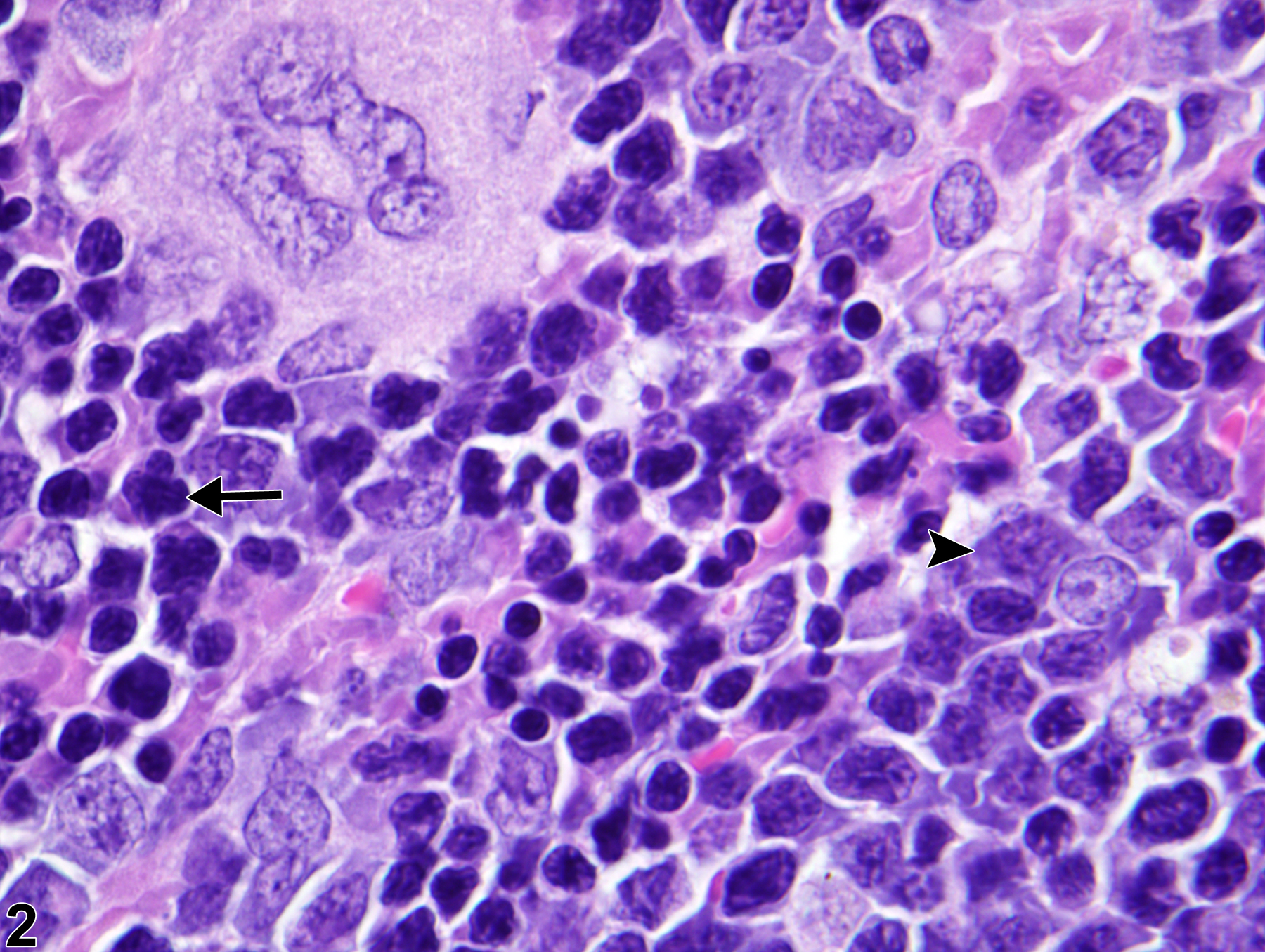 Image of extramedullary hematopoiesis in the spleen from a male B6C3F1/N mouse in a chronic study