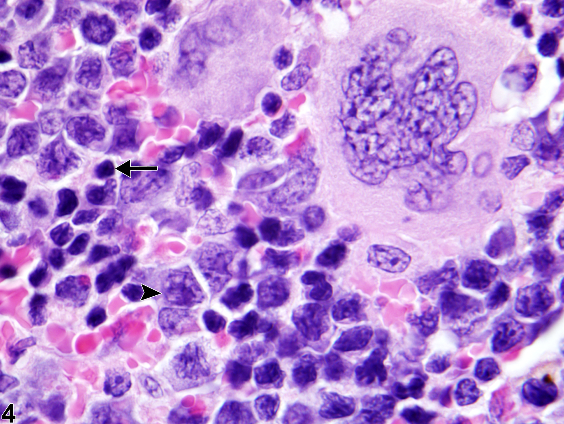 Image of extramedullary hematopoiesis in the spleen from a male B6C3F1/N mouse in a chronic study