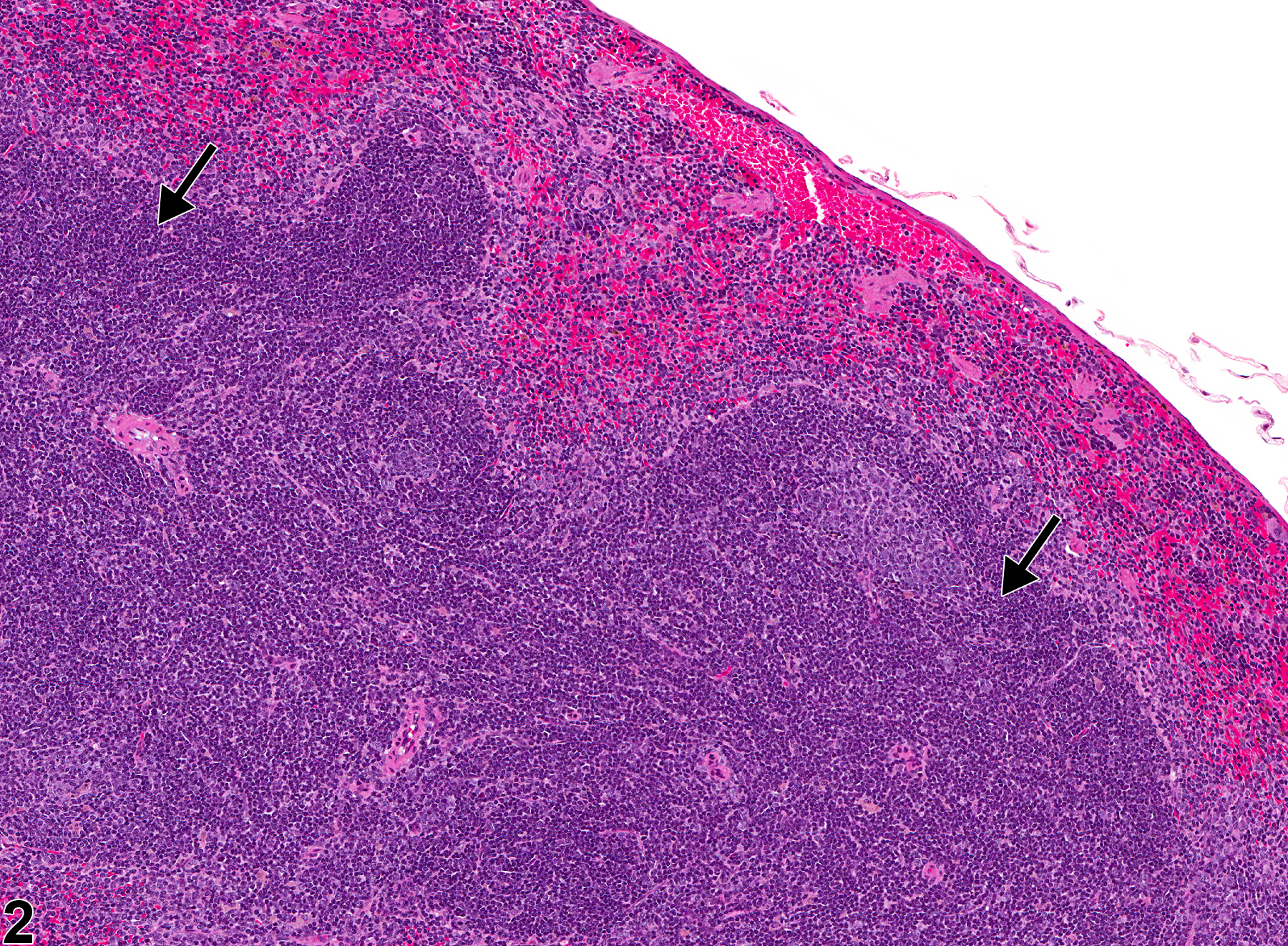 Image of hyperplasia, lymphocyte in the spleen from a male B6C3F1/N mouse in a chronic study