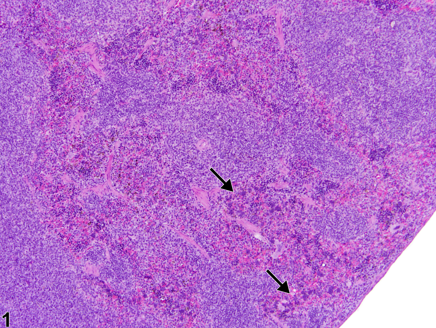 Image of hyperplasia, mast cell in the spleen from a female B6C3F1/N mouse in a chronic study